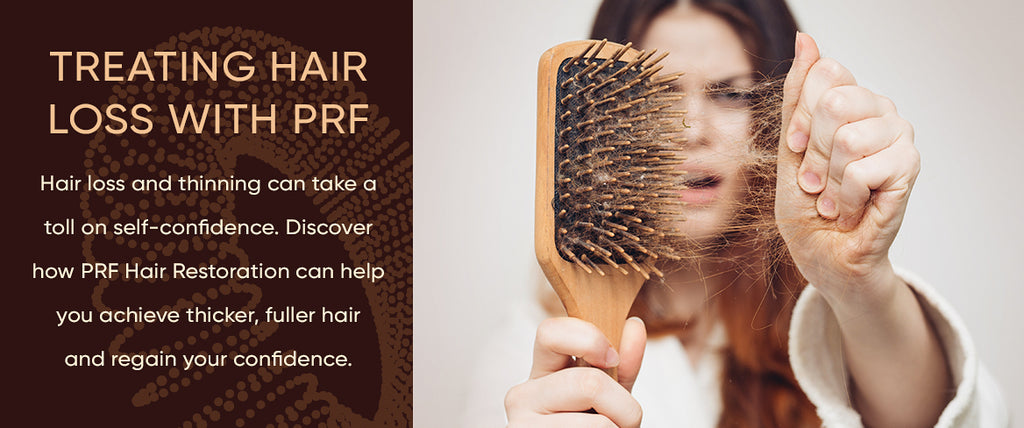 Treating Hair Loss with PRF