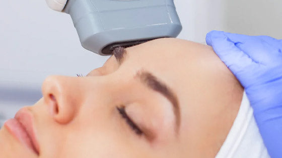 IPL & Chemical Peel Combo at Omni Centers