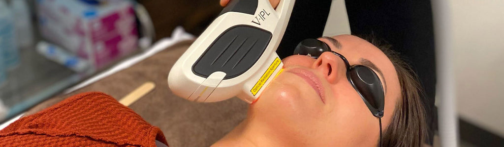 IPL Photofacial: Top 8 for Summer Sun Damage Reversal