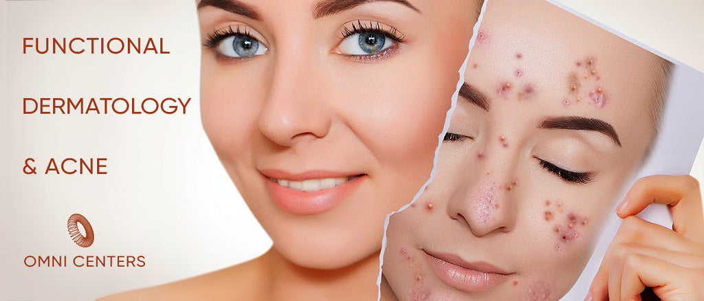 Functional Dermatology & Acne