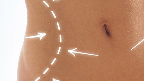 What to expect with CoolSculpting, and how much does it COST?