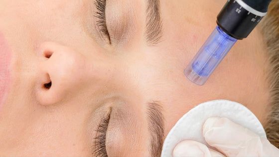Microneedling for Optimal Skin Health at Omni Centers